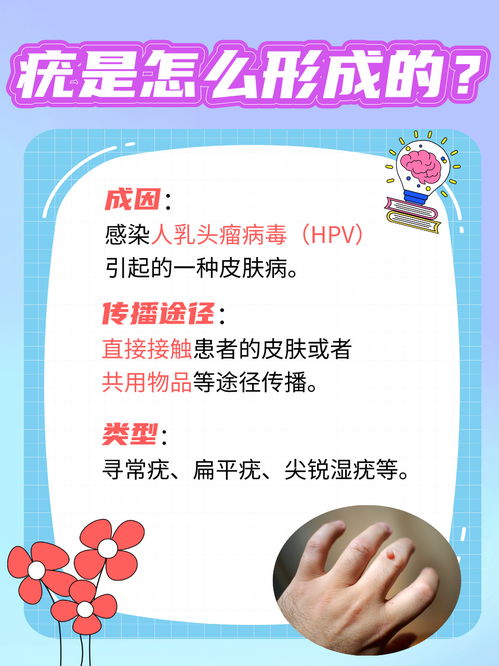 疣的奥秘 成因、治疗与日常护理全解析